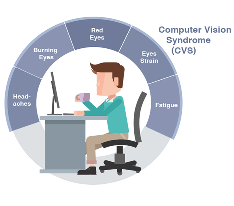 COMPUTER VISION SYNDROME (CVS) 